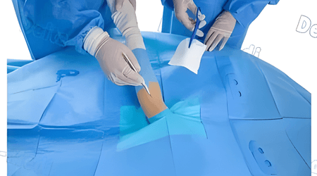 Upper Extremity Pack