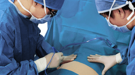 Thoracic and Abdominal Pack