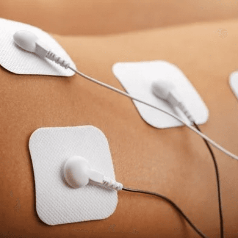 Electrotherapy & Modalities